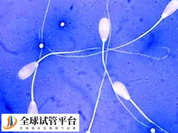 精子活力不好是不是只能做试管婴儿