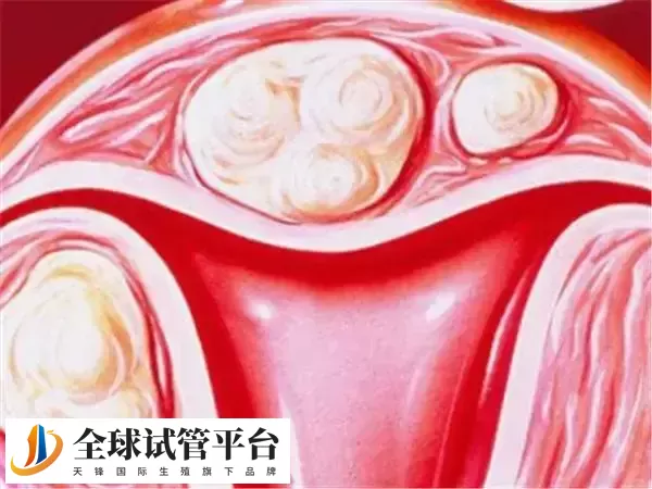 内膜20mm能否移植成功