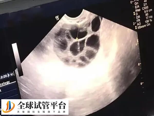 为什么打了促排针卵泡还长这么慢