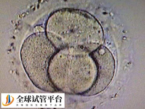 试管婴儿移植失败是怎么回事