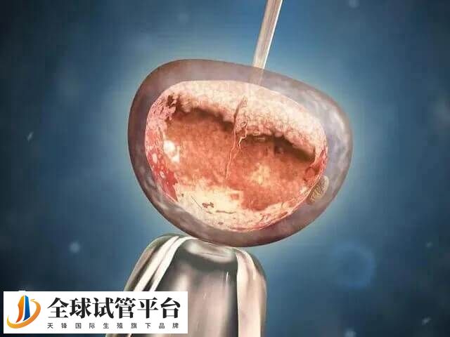 自然周期移植需满足哪些要求