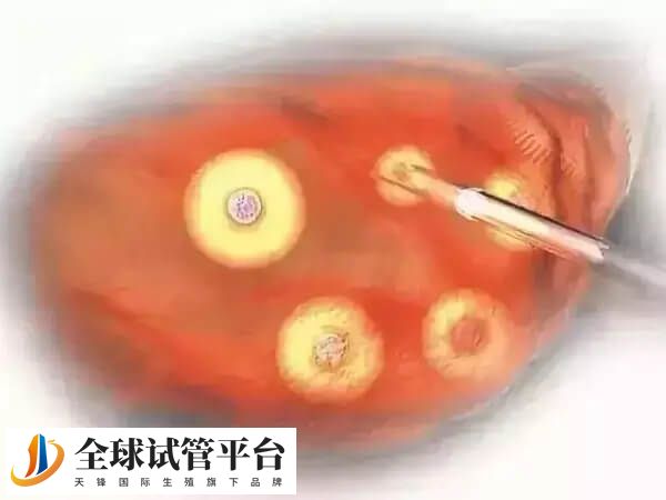 取卵后有血块流出是什么原因