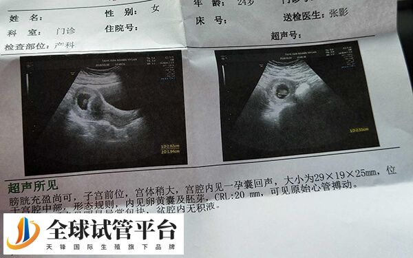 试管怀孕后胎芽不长怎么回事