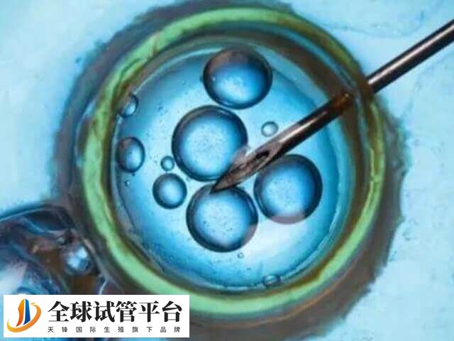 上海市当地的试管医疗资源是很丰富的