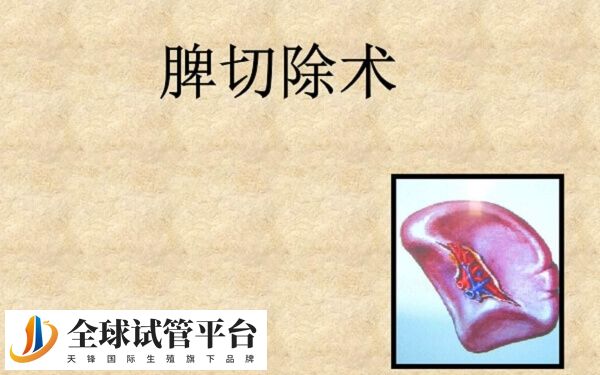 脾切除术