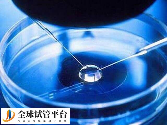精子卵子冷冻费的缴纳方式取决于地区