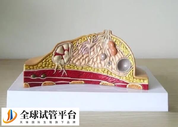 内膜异位试管怎么样才能成功