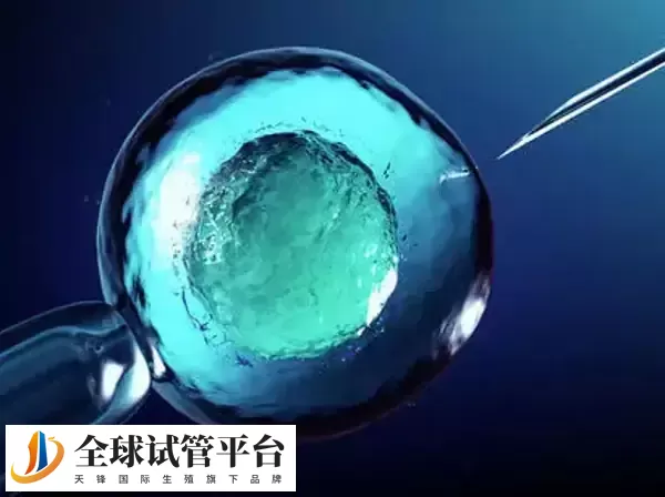 试管要不要查胰岛素抵抗