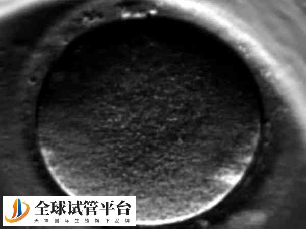 试管一管2个是不是必须一起解冻