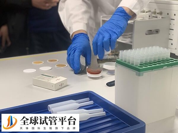 养囊并非对所有患者都必要