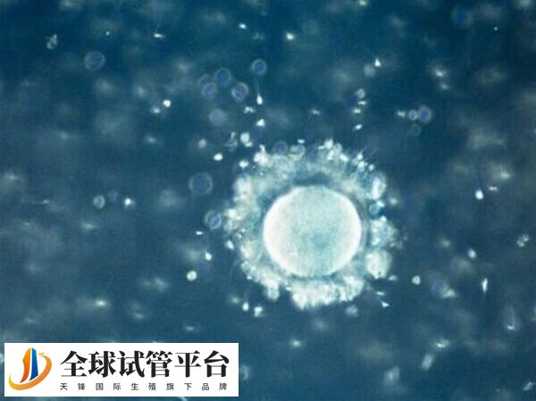 影响卵子存活时间的因素主要有3个