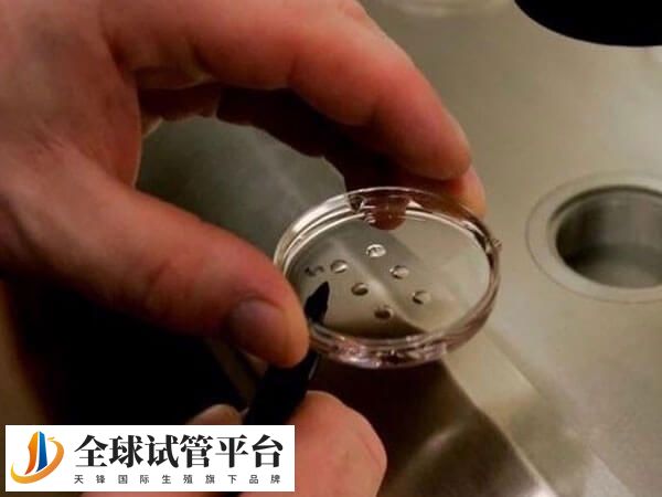 胚胎移植是三代试管的重要步骤