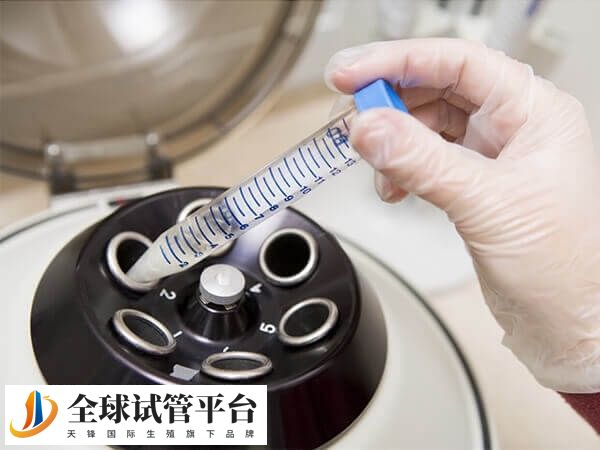 巴中本地哪家不孕不育医院做人工授精技术好成功率高？