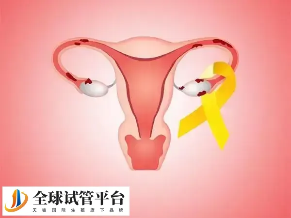 子宫腺肌症患者如何成功怀孕