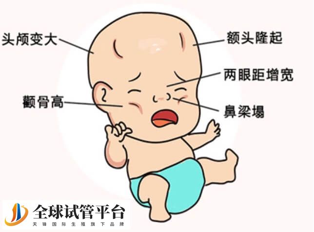 地中海贫血的诊断的方法有哪些