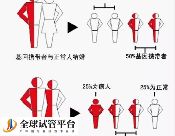 地中海贫血遗传规律