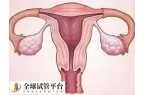 移植囊胚会不会出现宫外孕