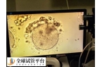 试管婴儿ivm是什么意思